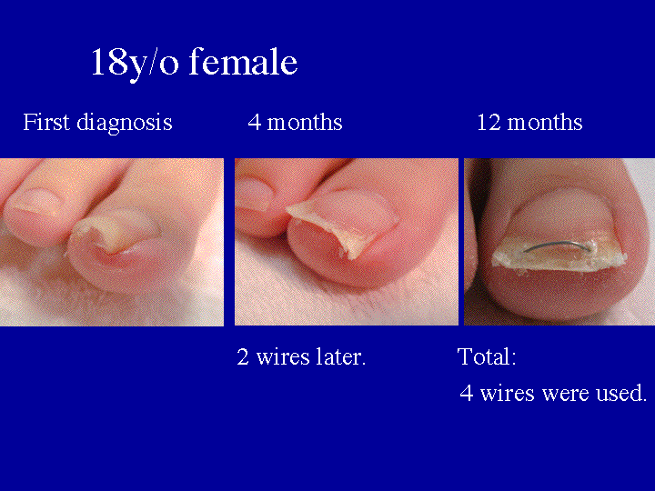 Slide 11 (18y/o patient) 