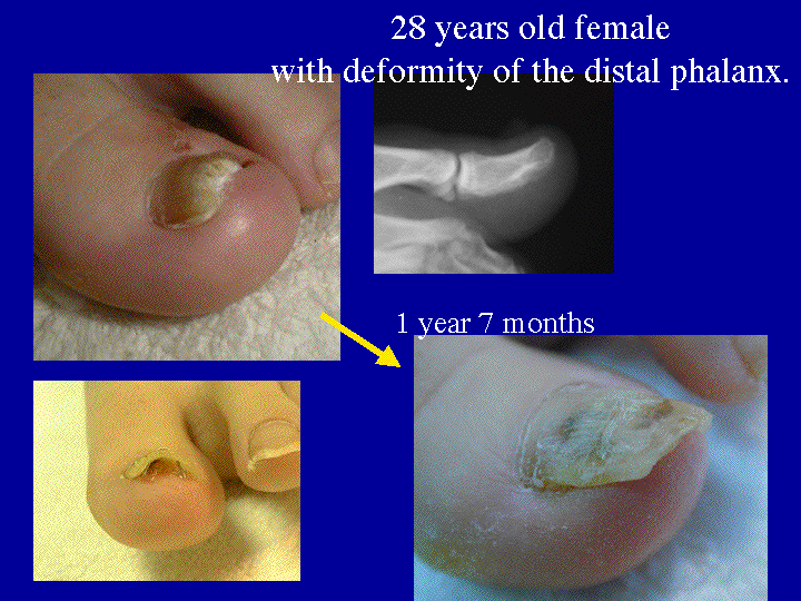 Slide 12 (28y/o patient) 